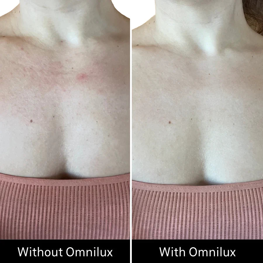 Omnilux Contour Neck & Décolleté LED Mask + Pack x 3 Hydrogel Masks $629