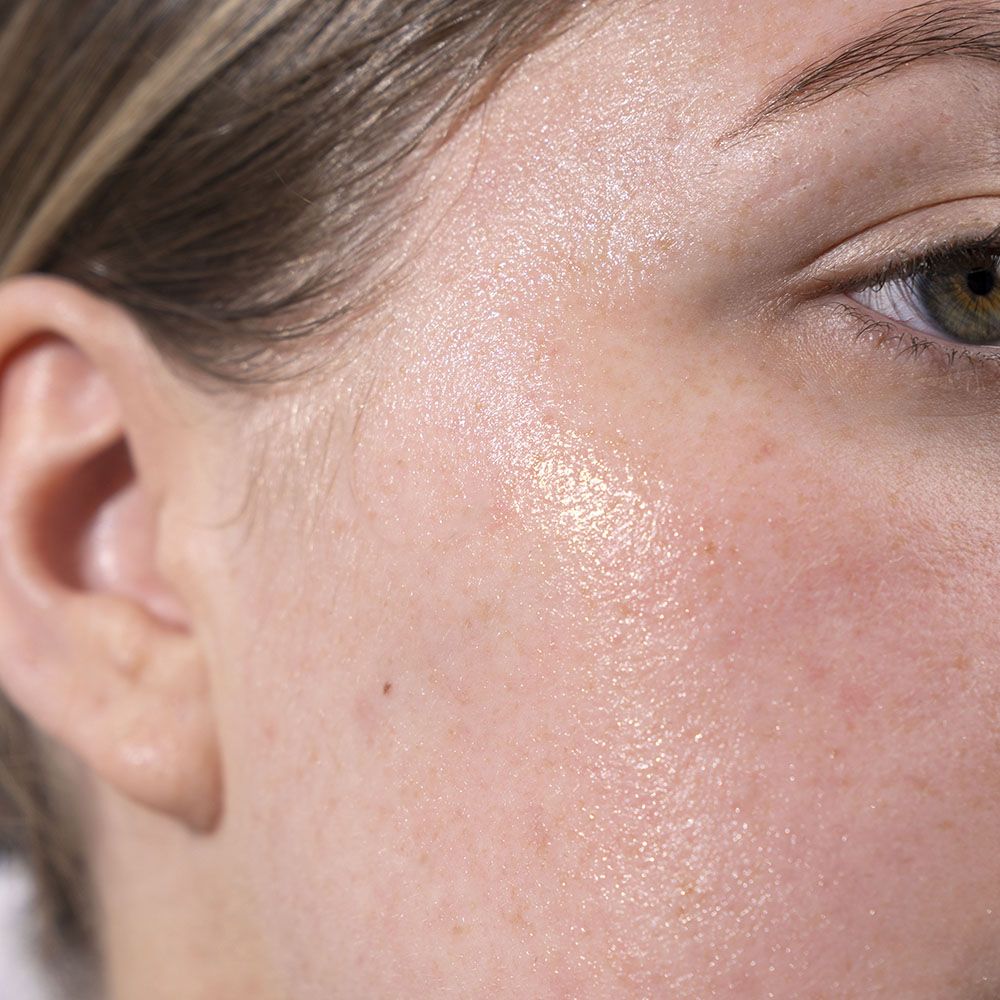 Dry Skin vs Dehydrated Skin: Why They aren't the Same