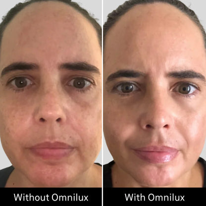 Omnilux Contour Face LED Mask + 3x Pack of Hydrogel Face Masks $629