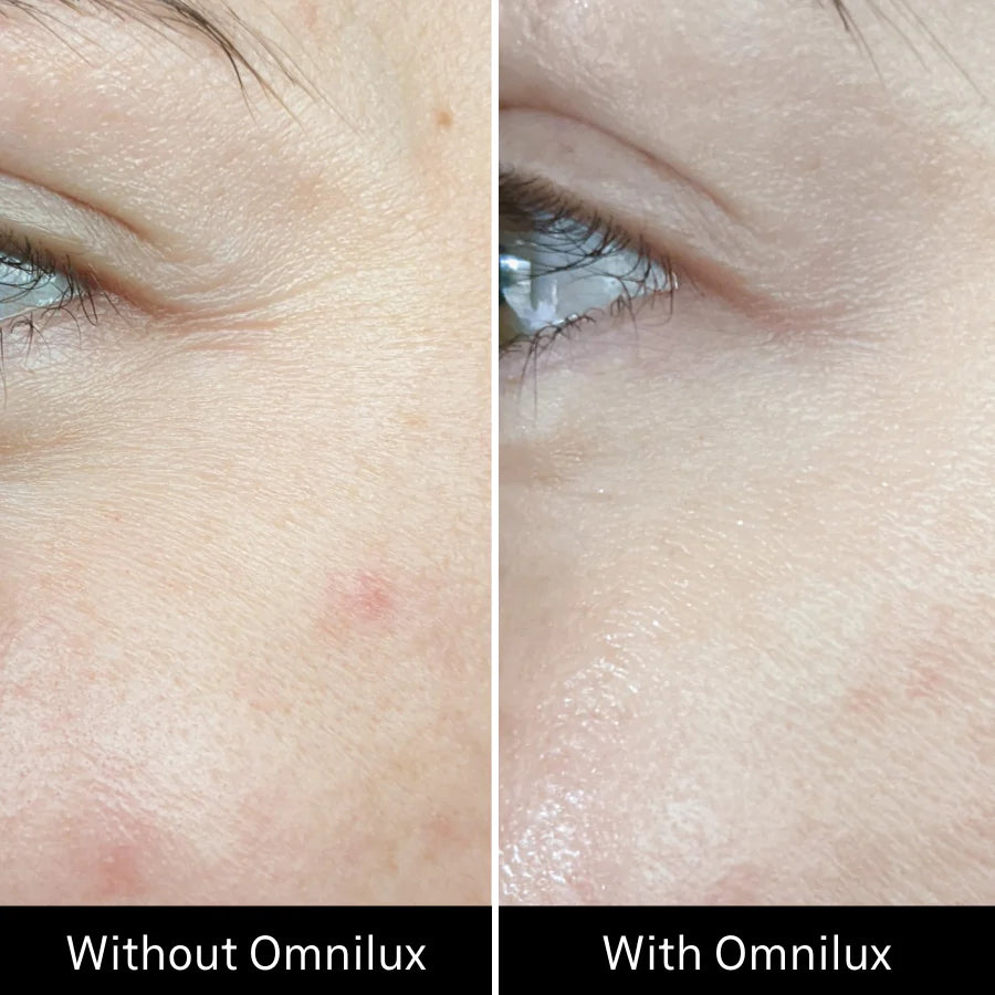 Omnilux Contour Face LED Mask + 3x Pack of Hydrogel Face Masks $629