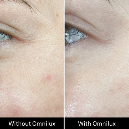 Omnilux Contour Face LED Mask + 3x Pack of Hydrogel Face Masks $629