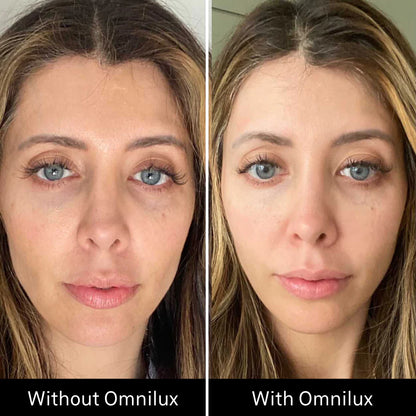 Omnilux Contour Face LED Mask + 3x Pack of Hydrogel Face Masks $629