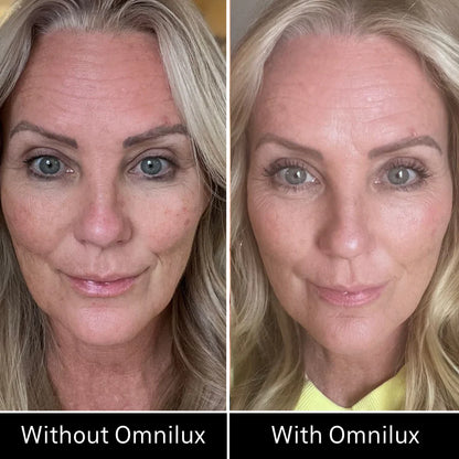 Omnilux Contour Face LED Mask + 3x Pack of Hydrogel Face Masks $629